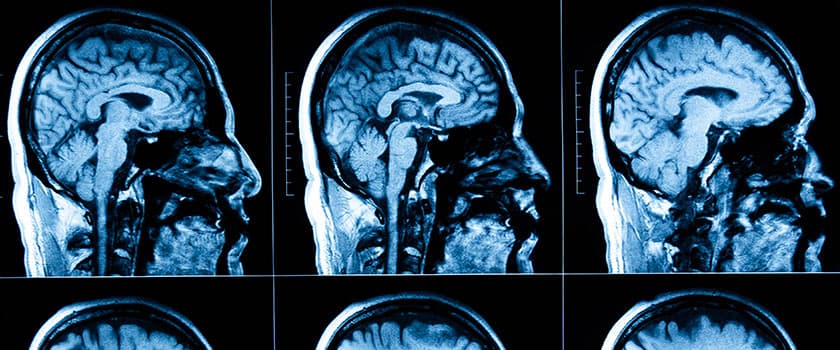Brain Tumor Detector